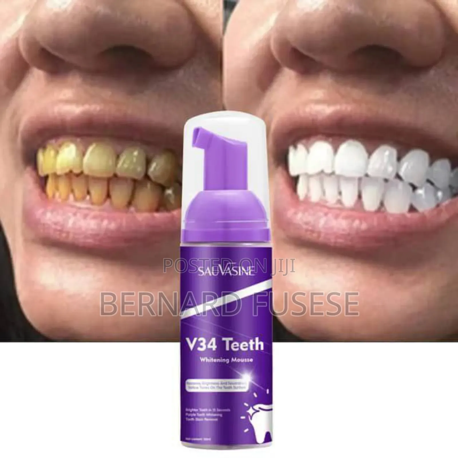 White Teeth