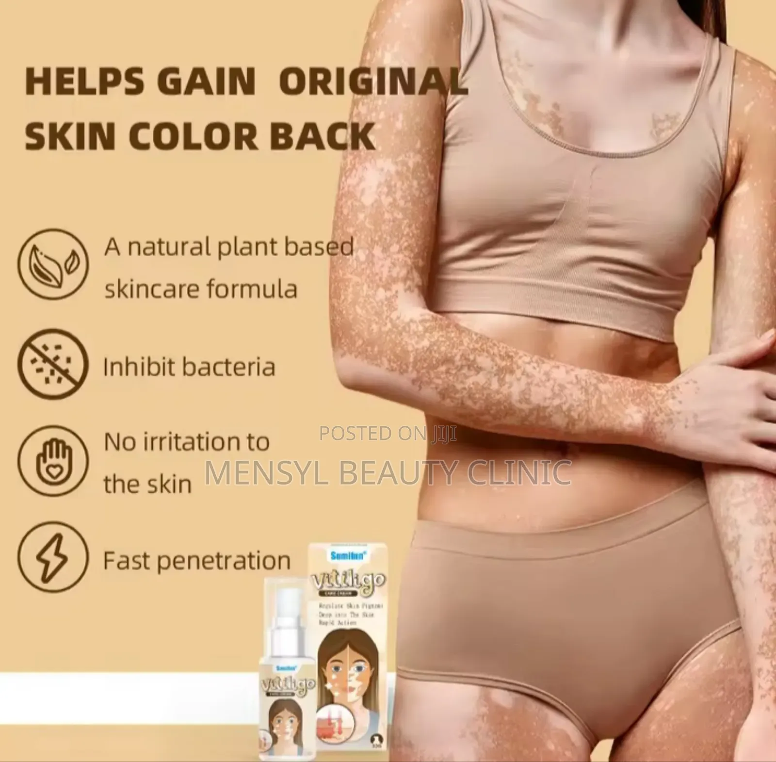 Vitiligo Spray Treatment, and White Spots on Skin