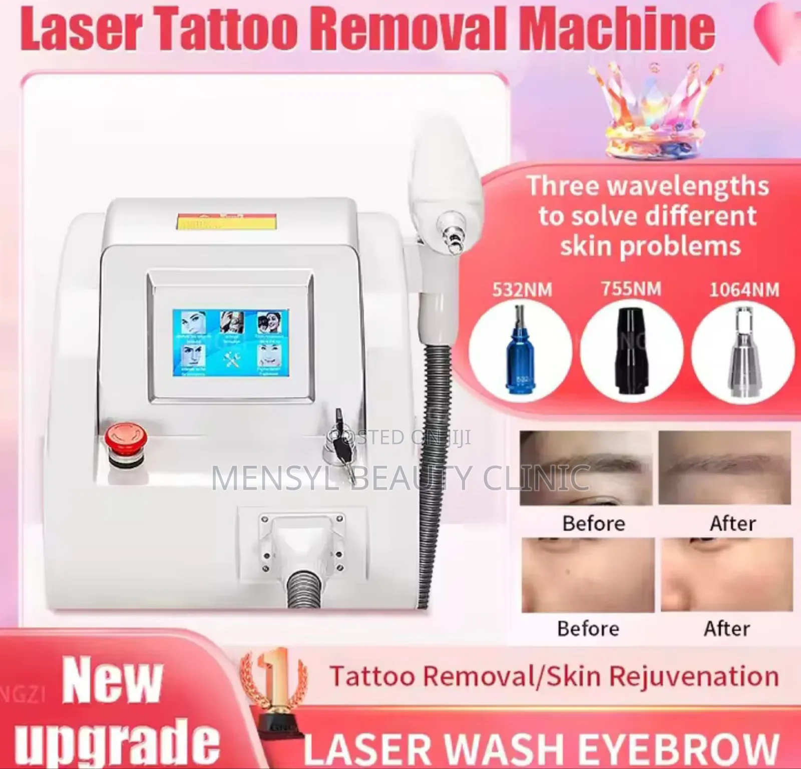 Q-Switched Lasers for Stretch Marks Tattoo Removal Machine