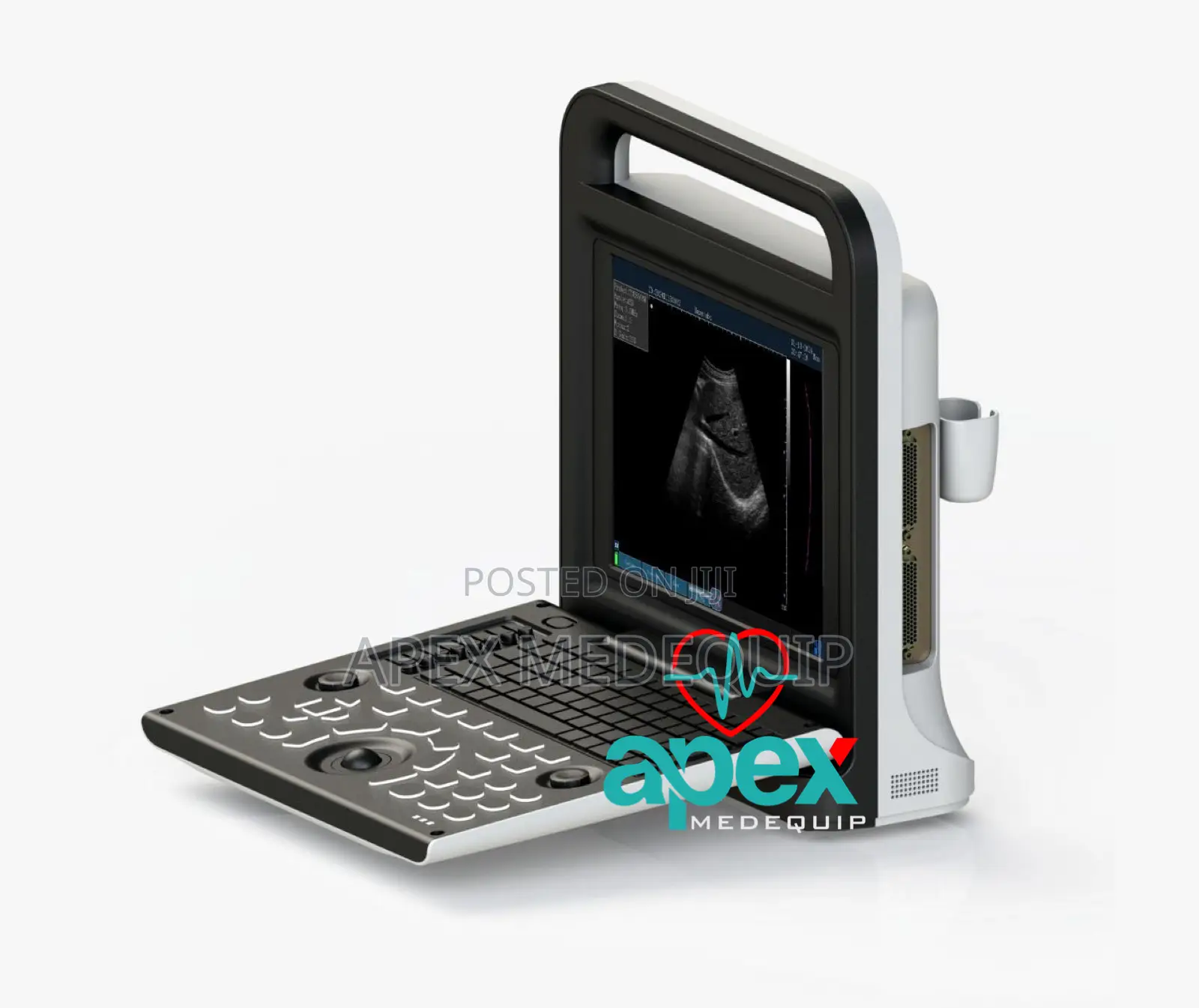 Brandnew Sonotec Dp-30 Digital Ultrasound System + Trolley