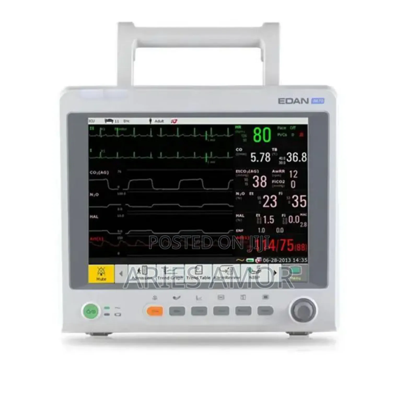 Vital Sign Monitor