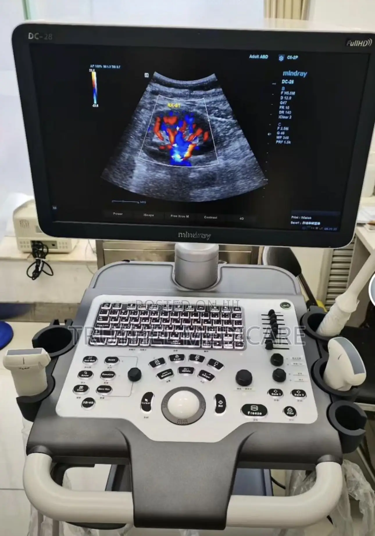Mindray Ultrasound Machine - Dc 32 Full Hd