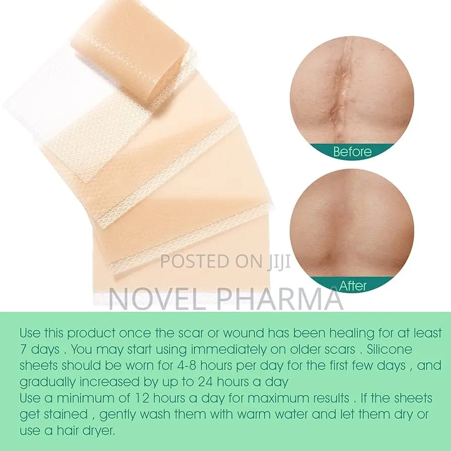 Silicone Scar Sheet