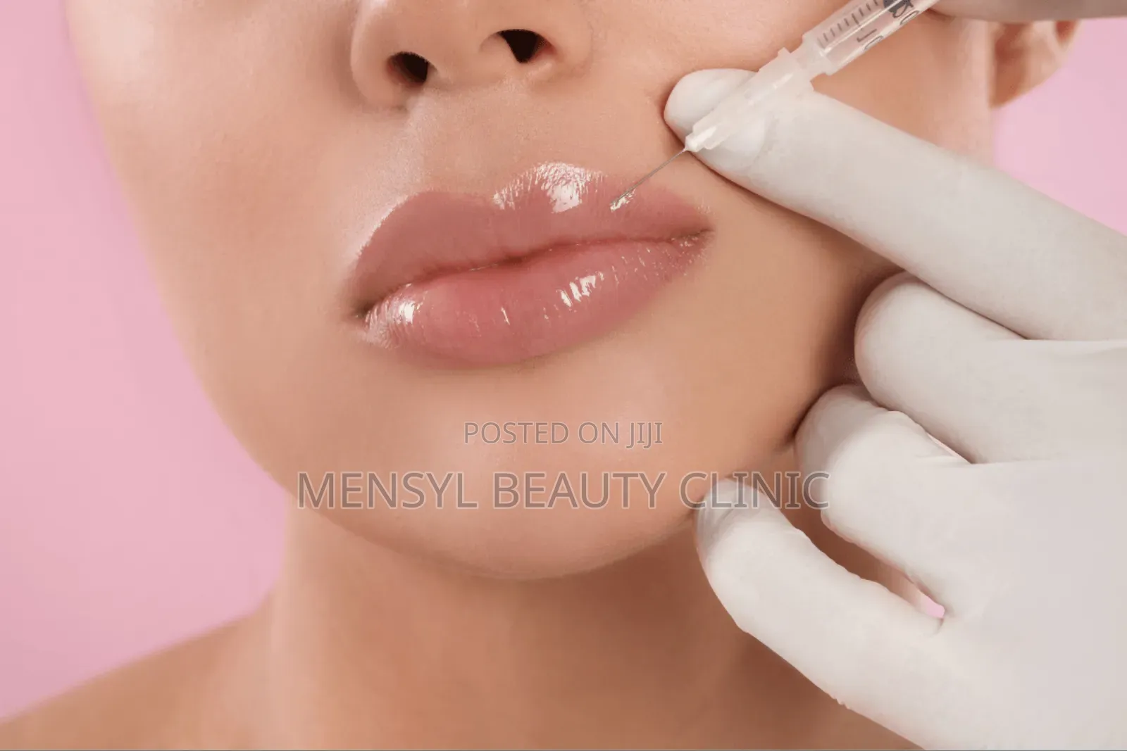 Bellast Ha Facial Filler Is Korean Dermal Fillers for Face
