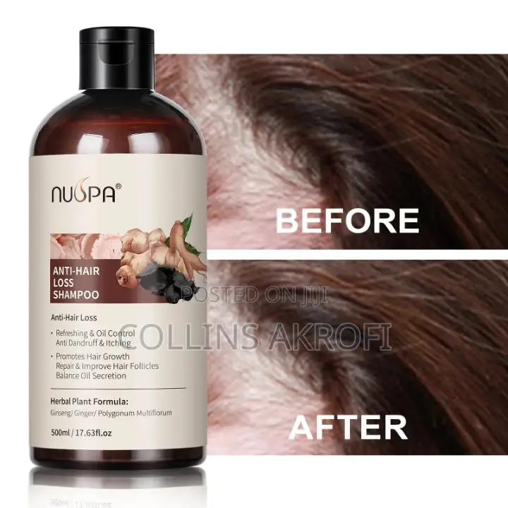 Anti Hair Loss, Haircare Set.