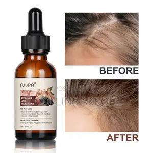 Anti Hair Loss, Haircare Set.