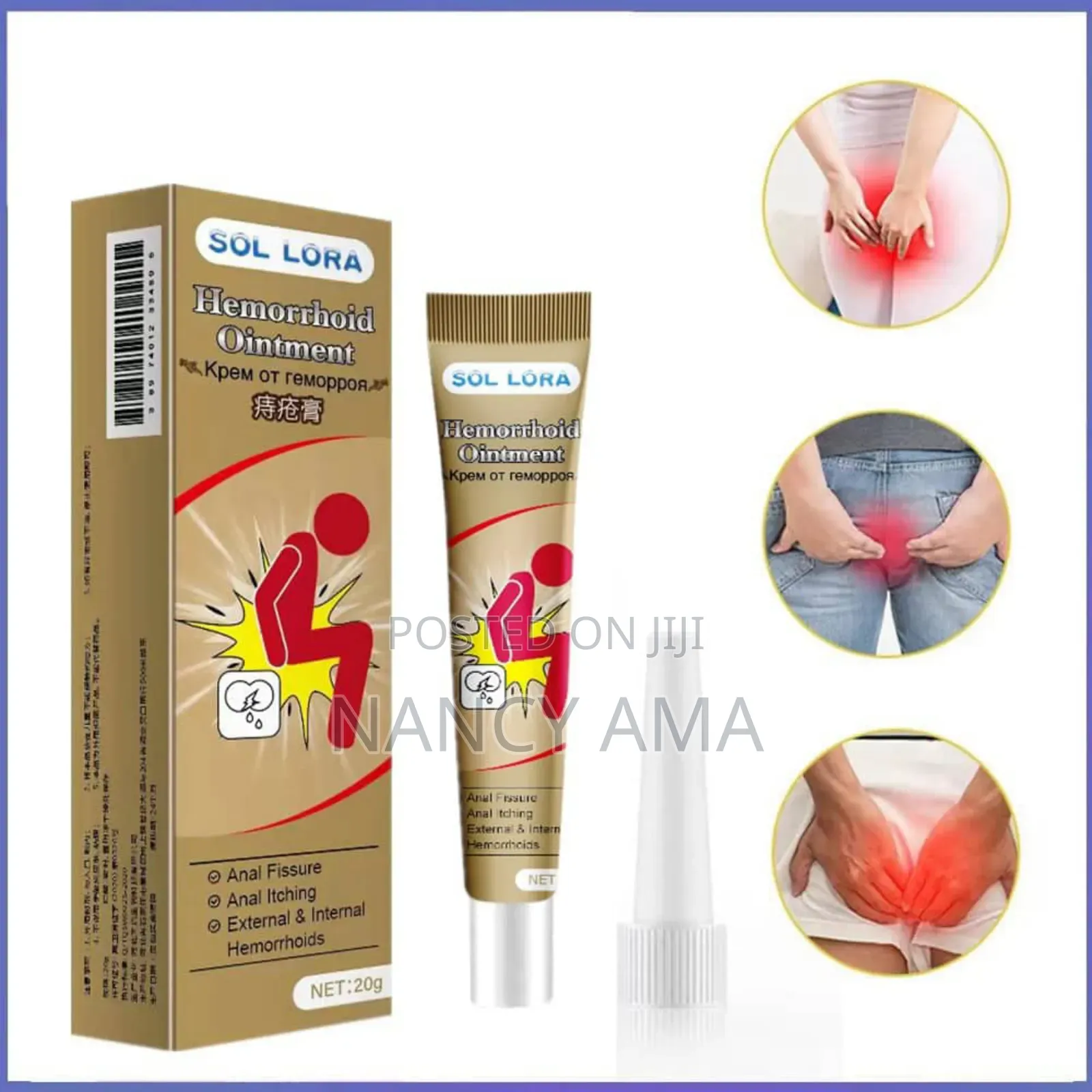 Hemorrhoid