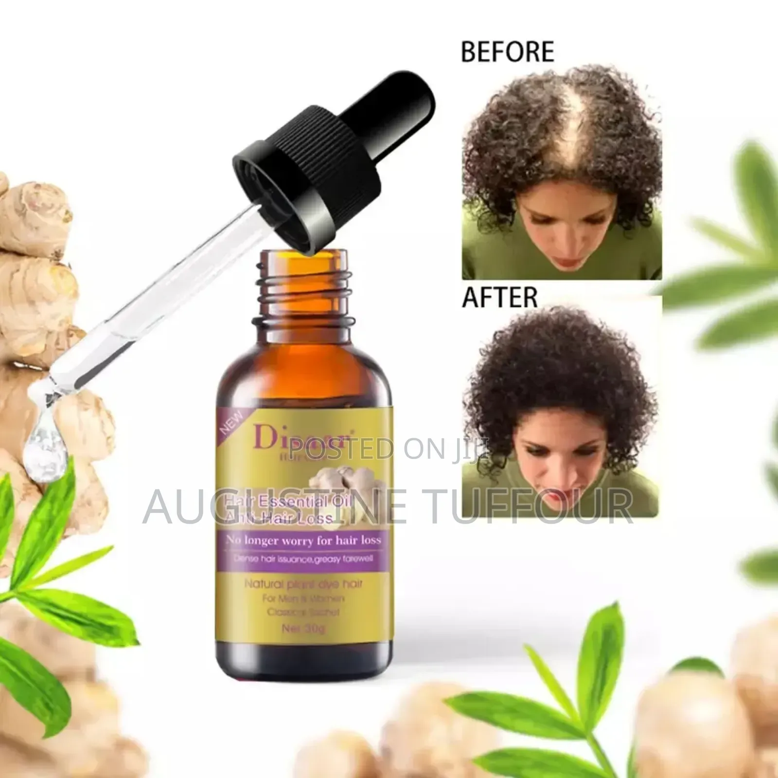 Disaar Hair Growth Oil and Anti Hair Loss