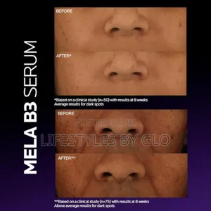 Mela B3 Dark Spot Serum With Melasyl + Niacinamide Serum