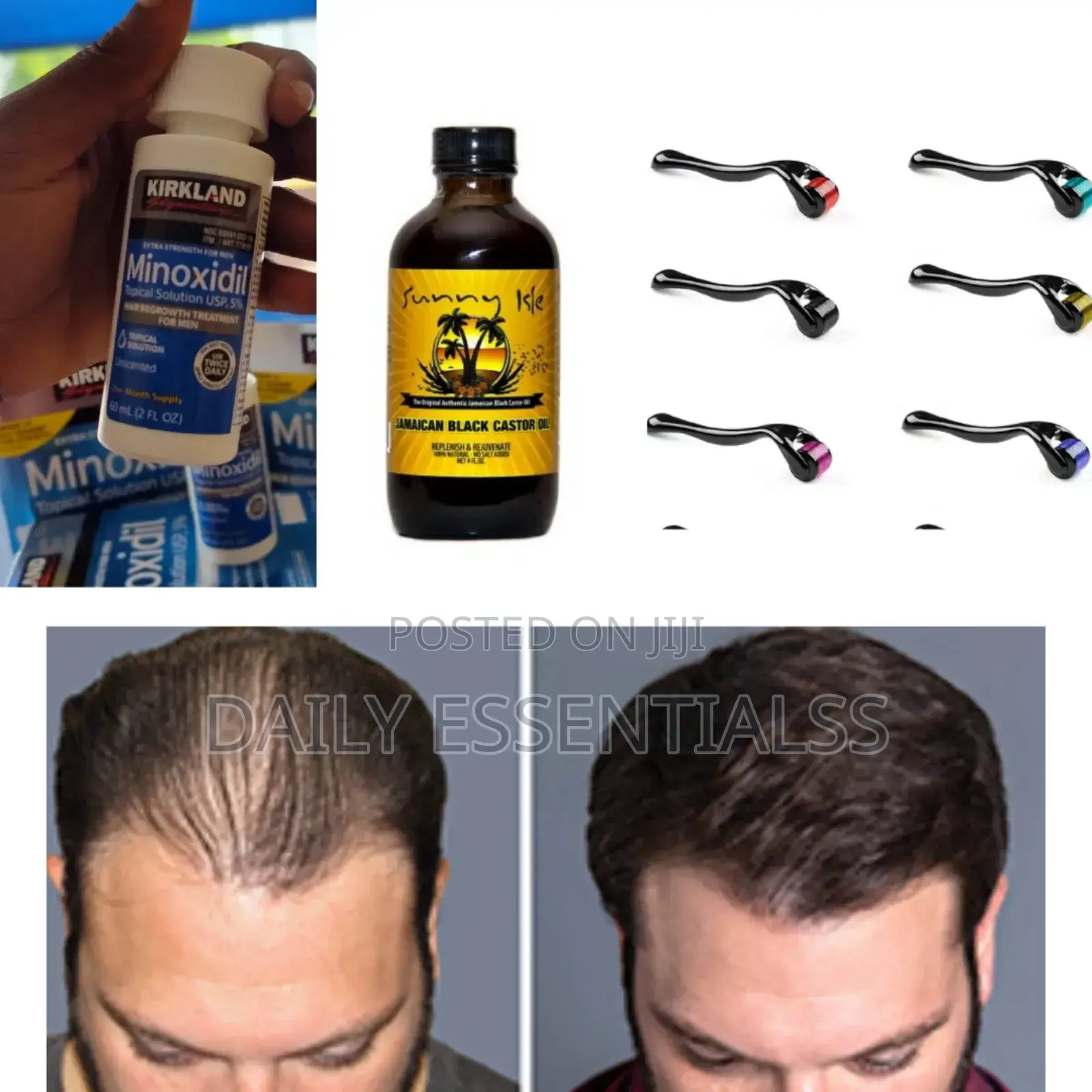 Hair Rescue Bundle – Fast Results