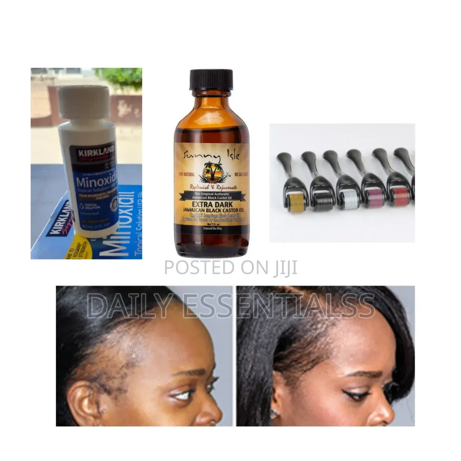 Advanced Hair Regrowth Combo (Best Seller)