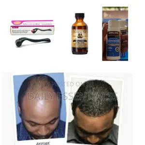 Power Growth Pack – Edges, Crown Beards