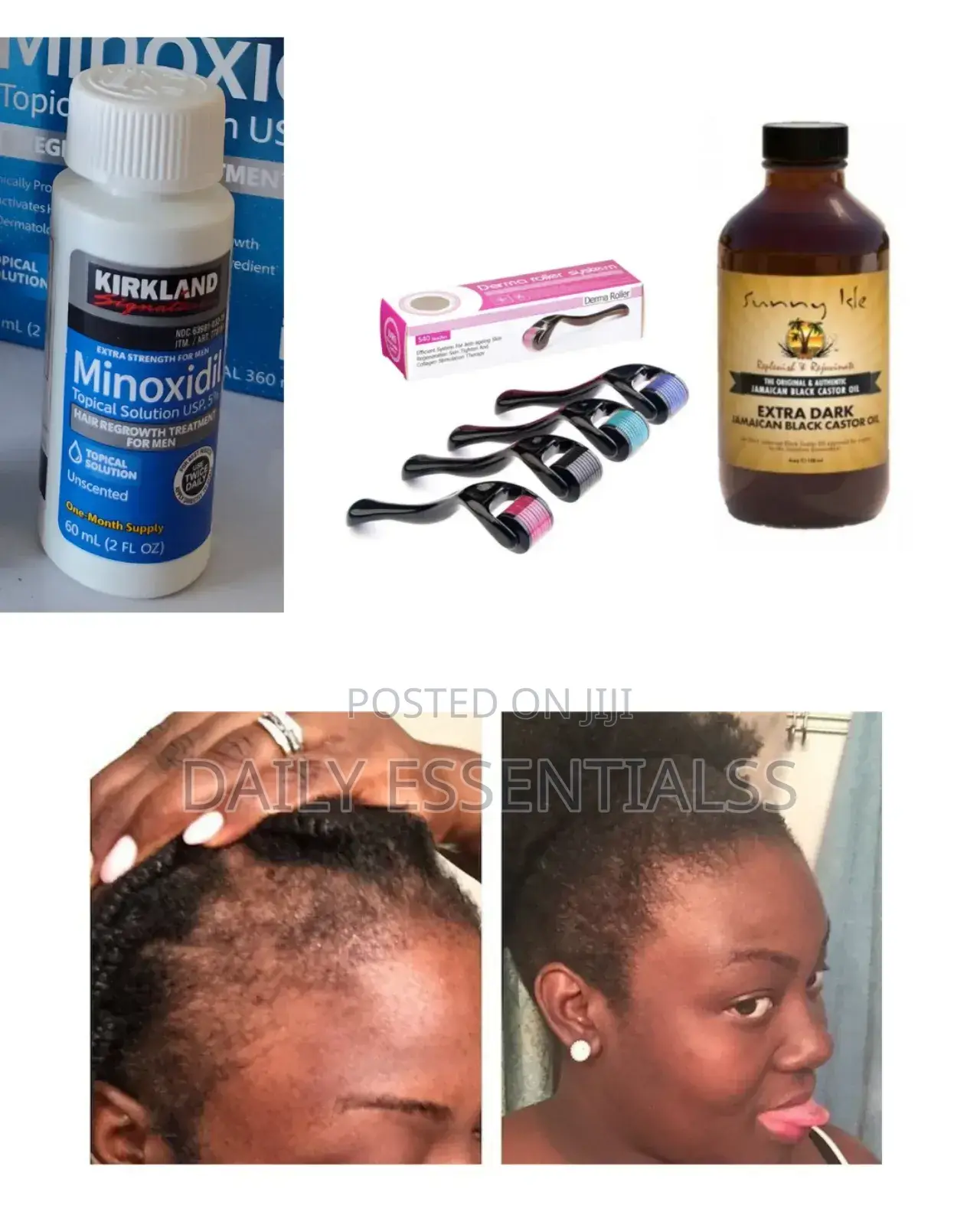 Hair Growth Essentials Kit