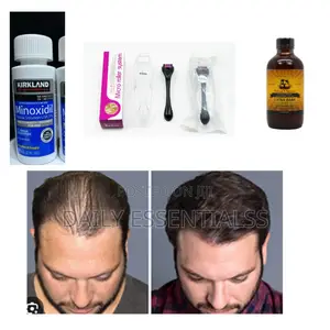 Balding? Thinning? This Set Is for You!