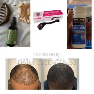 Kirkland Mielle Growth Set With Derma Roller