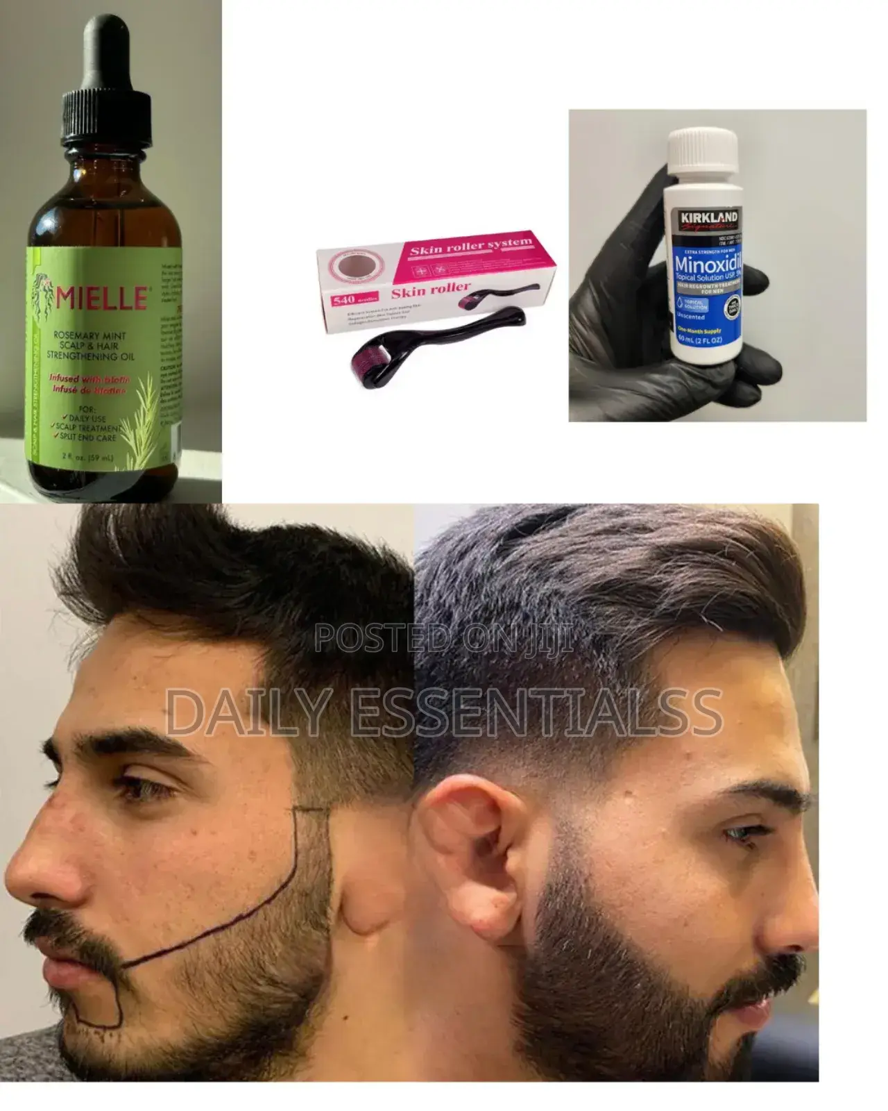 Hairline Beard Fix – Kirkland, Mielle, Derma Roller