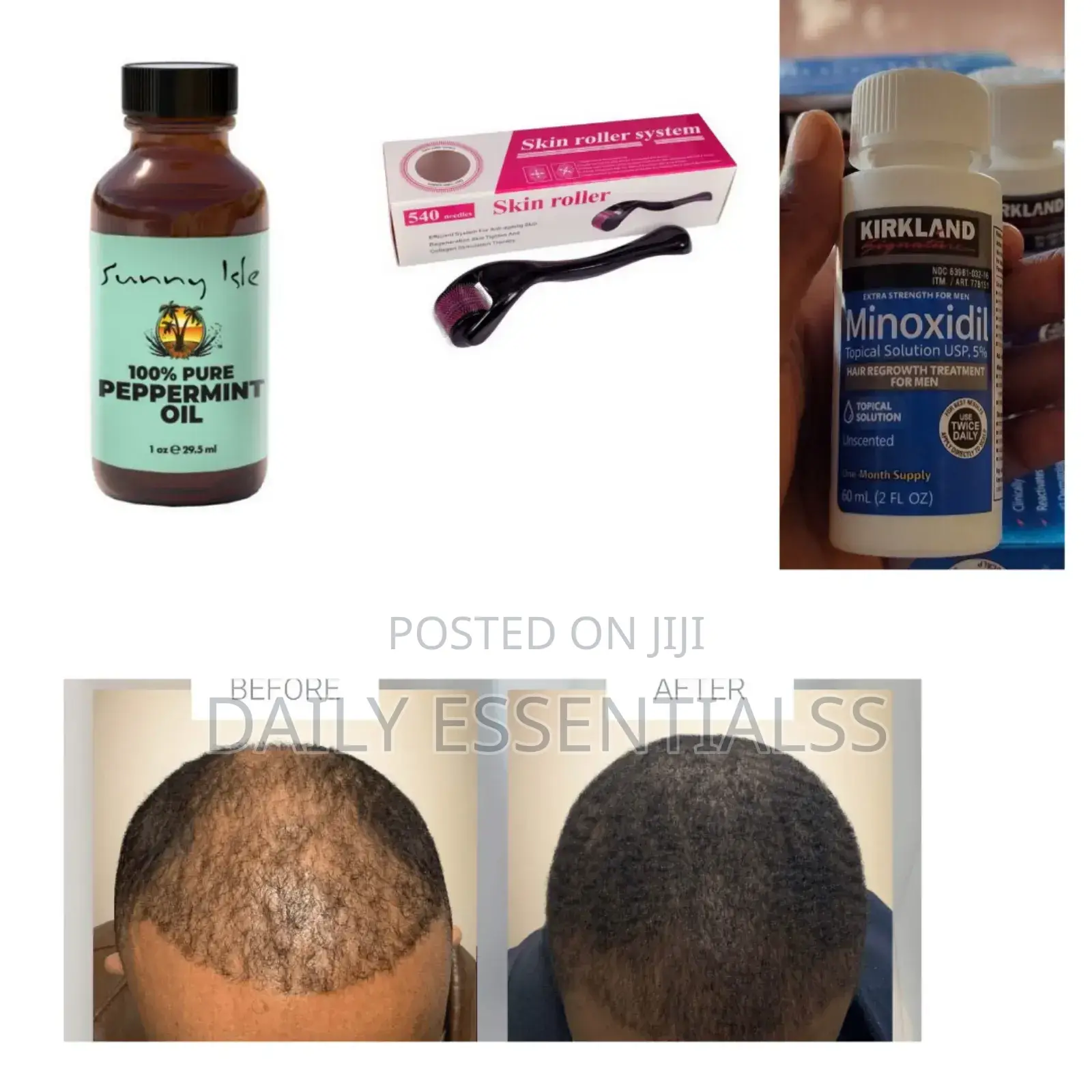 Kirkland, Peppermint Oil Derma Roller Growth Set