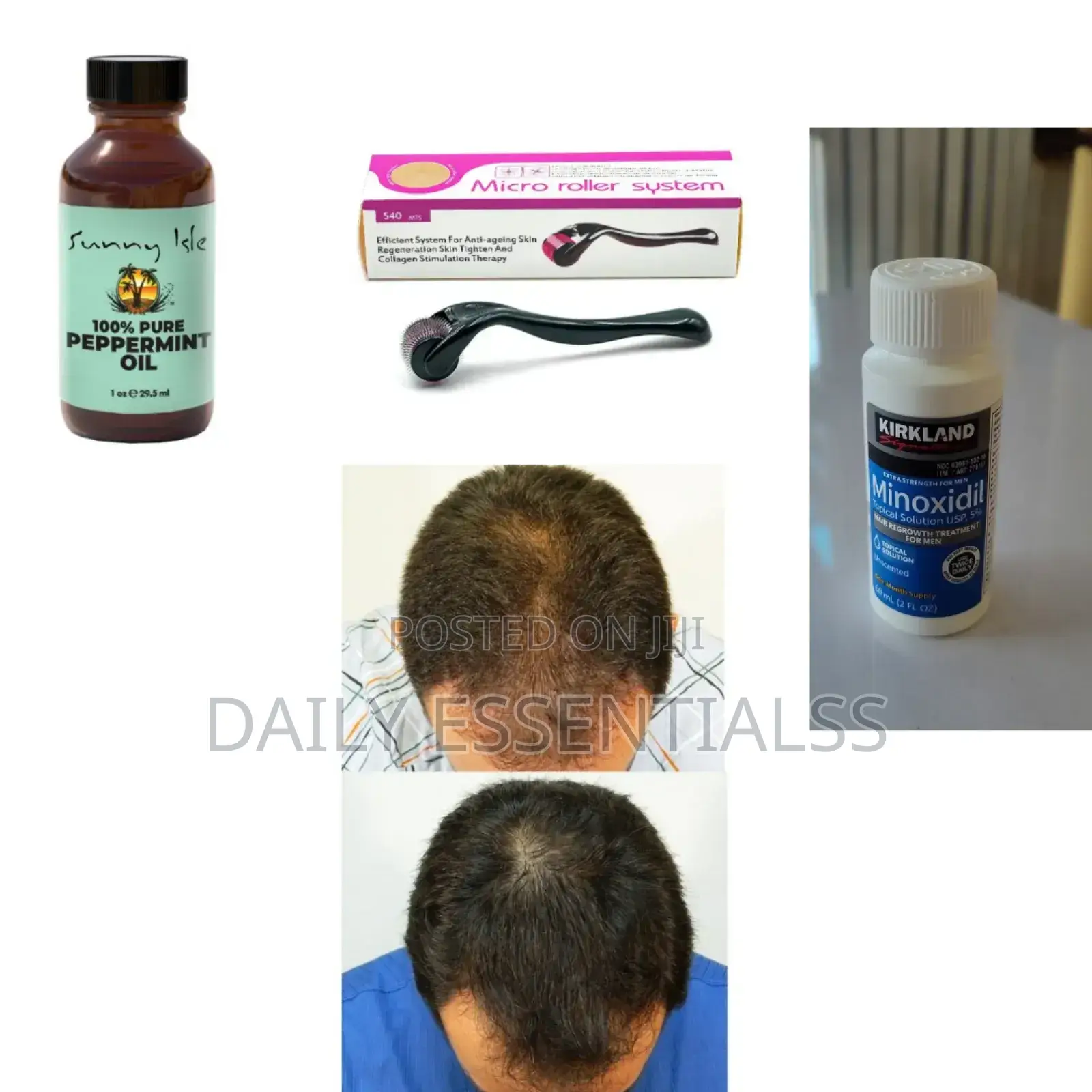 Kirkland+ Derma Roller +Peppermint Oil Hair Beard Booster