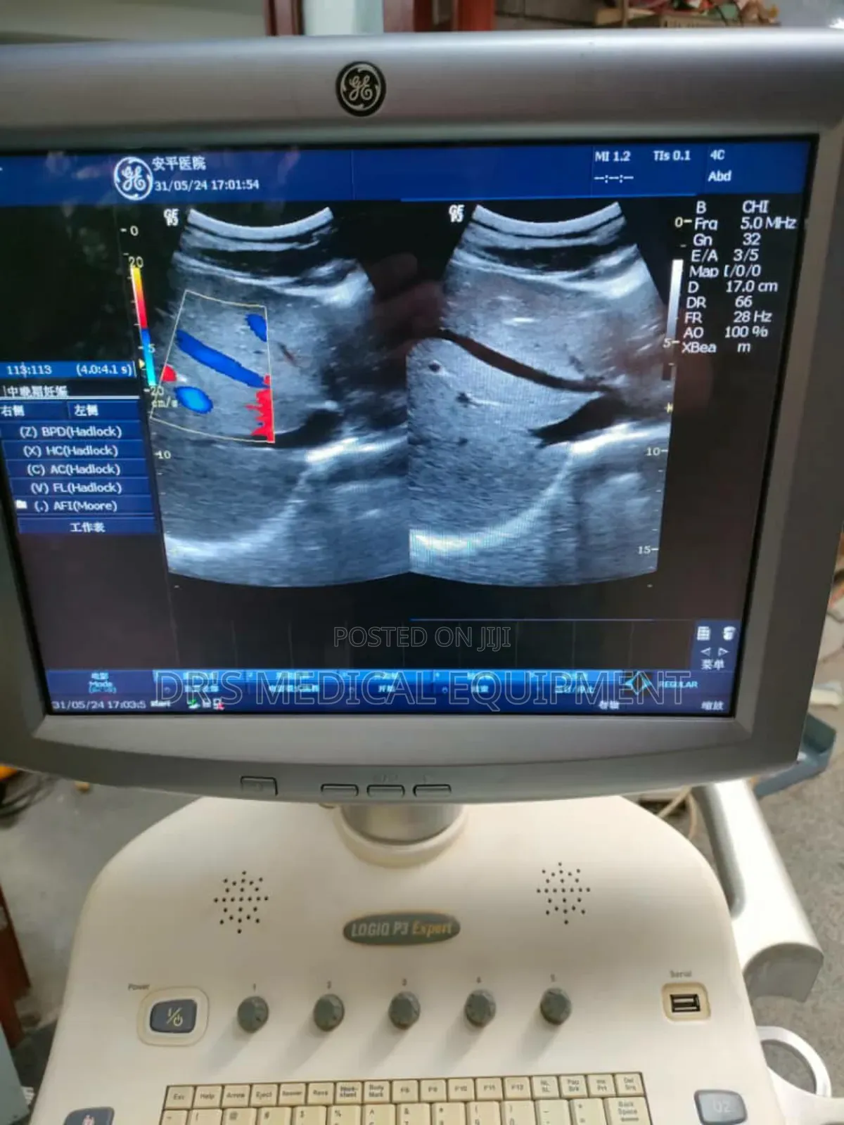 Slightly Foreign Used Ge Logic P3 Expert With 3probes + Printer