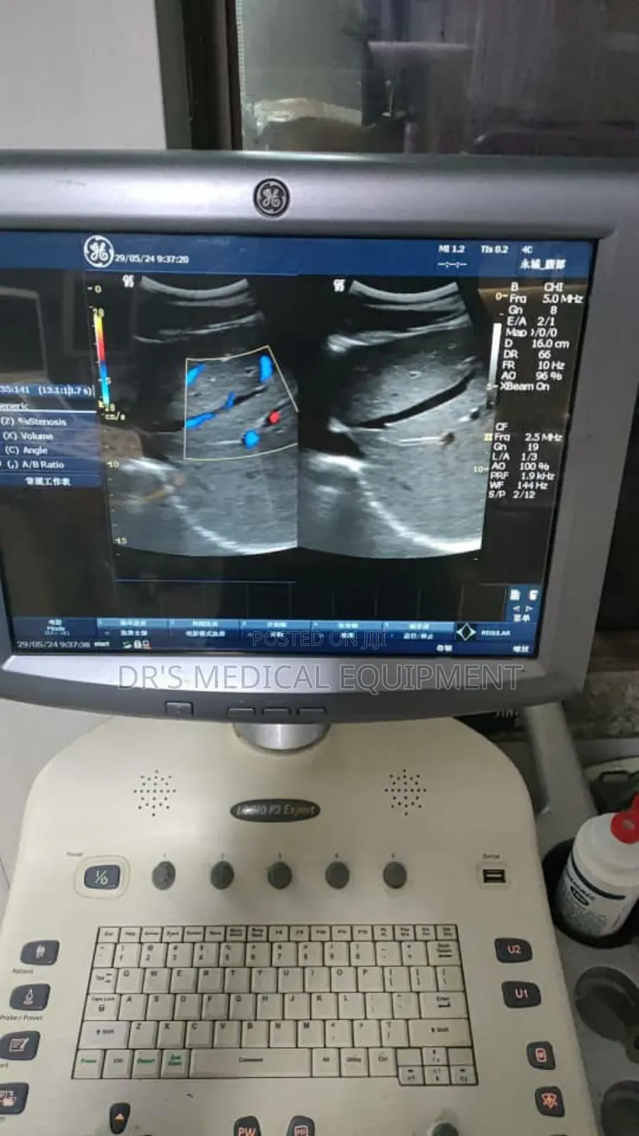 Slightly Foreign Used Ge Logic P3 Expert With 3probes + Printer