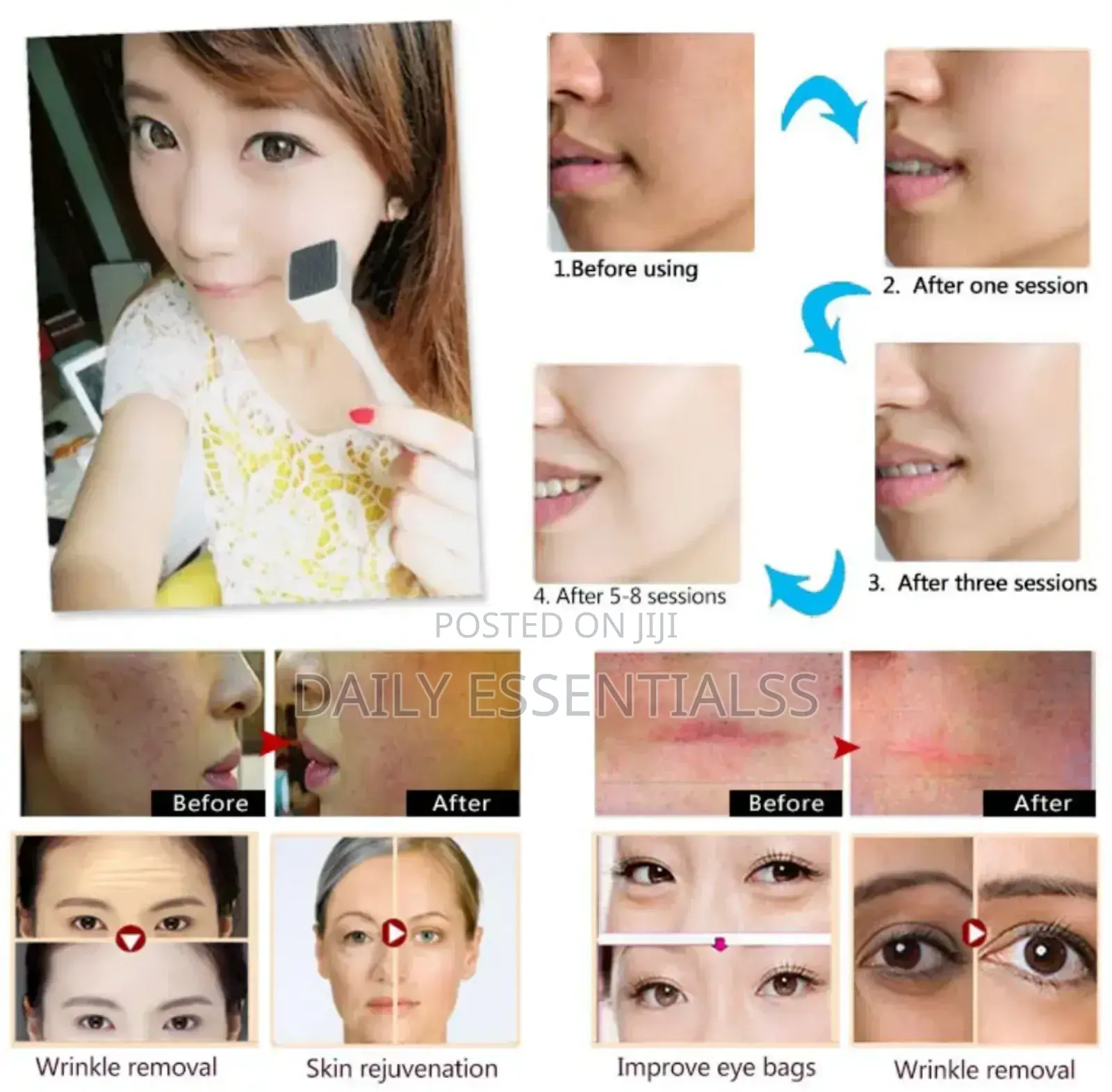 Micro-Pin Perfection – Derma Stamp Skincare Tool