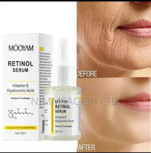 Photo - Mooyam Retinol Face Cream