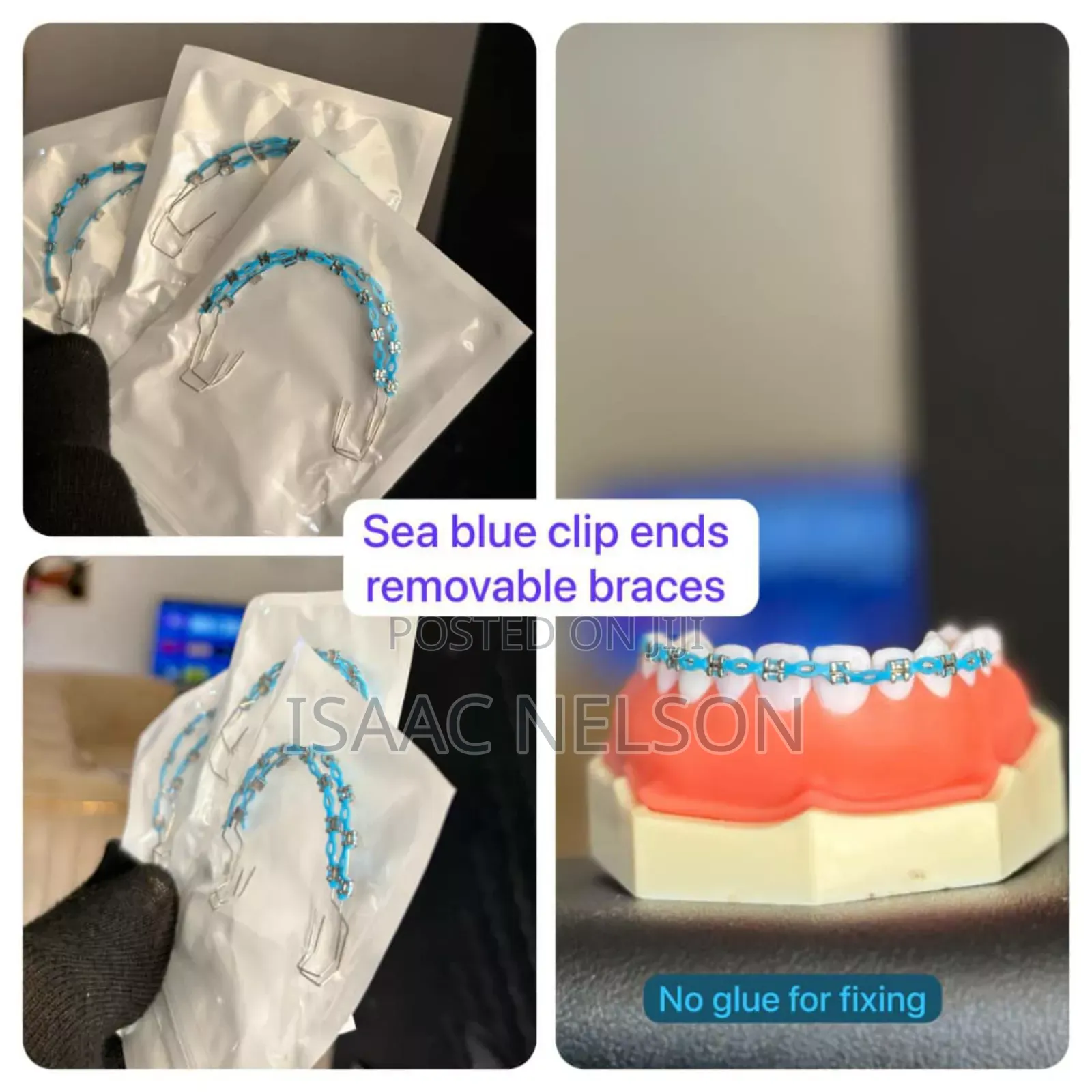 Teeth Braces