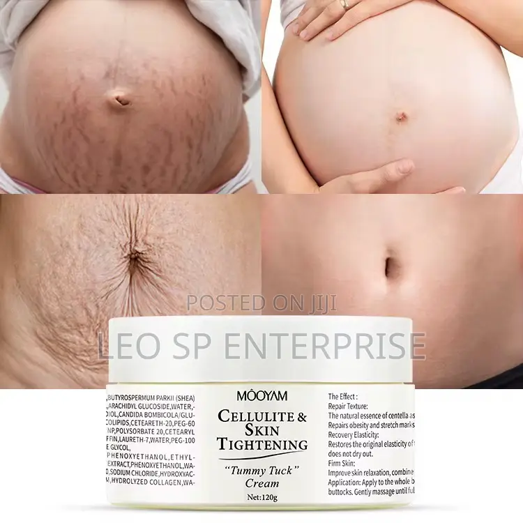 Mooyam Stretch Marks and After Pregnancy Cream