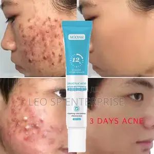 Photo - Pimples and Acne Cream