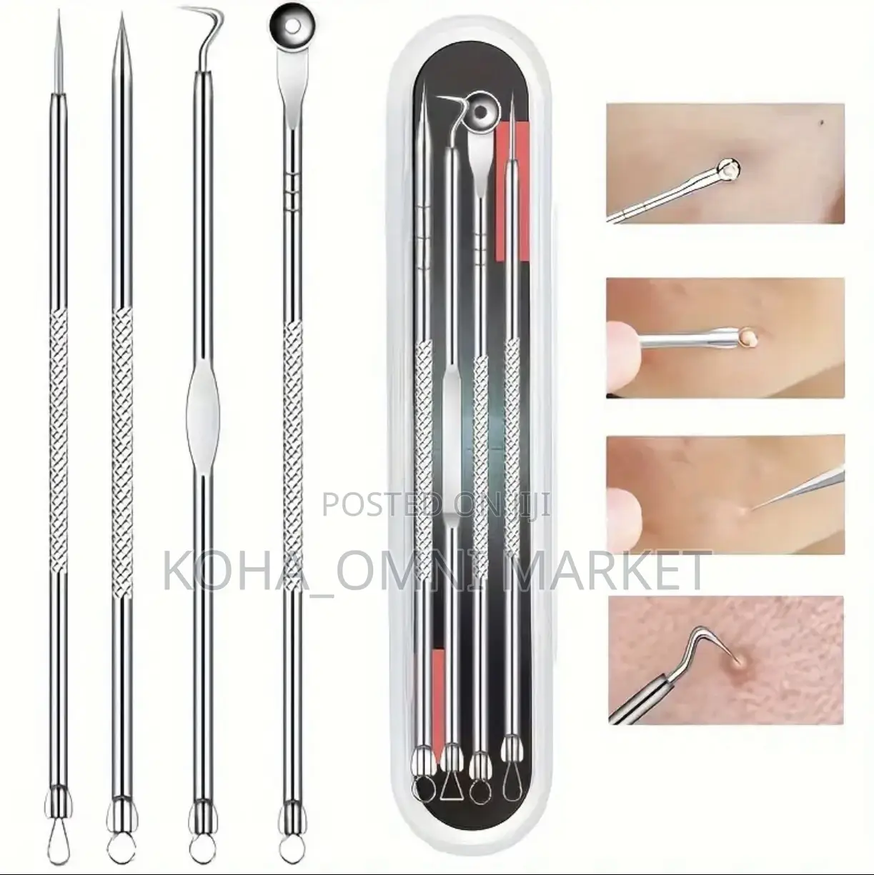 4pcs Pimple Extractor Tool Stainless Steel