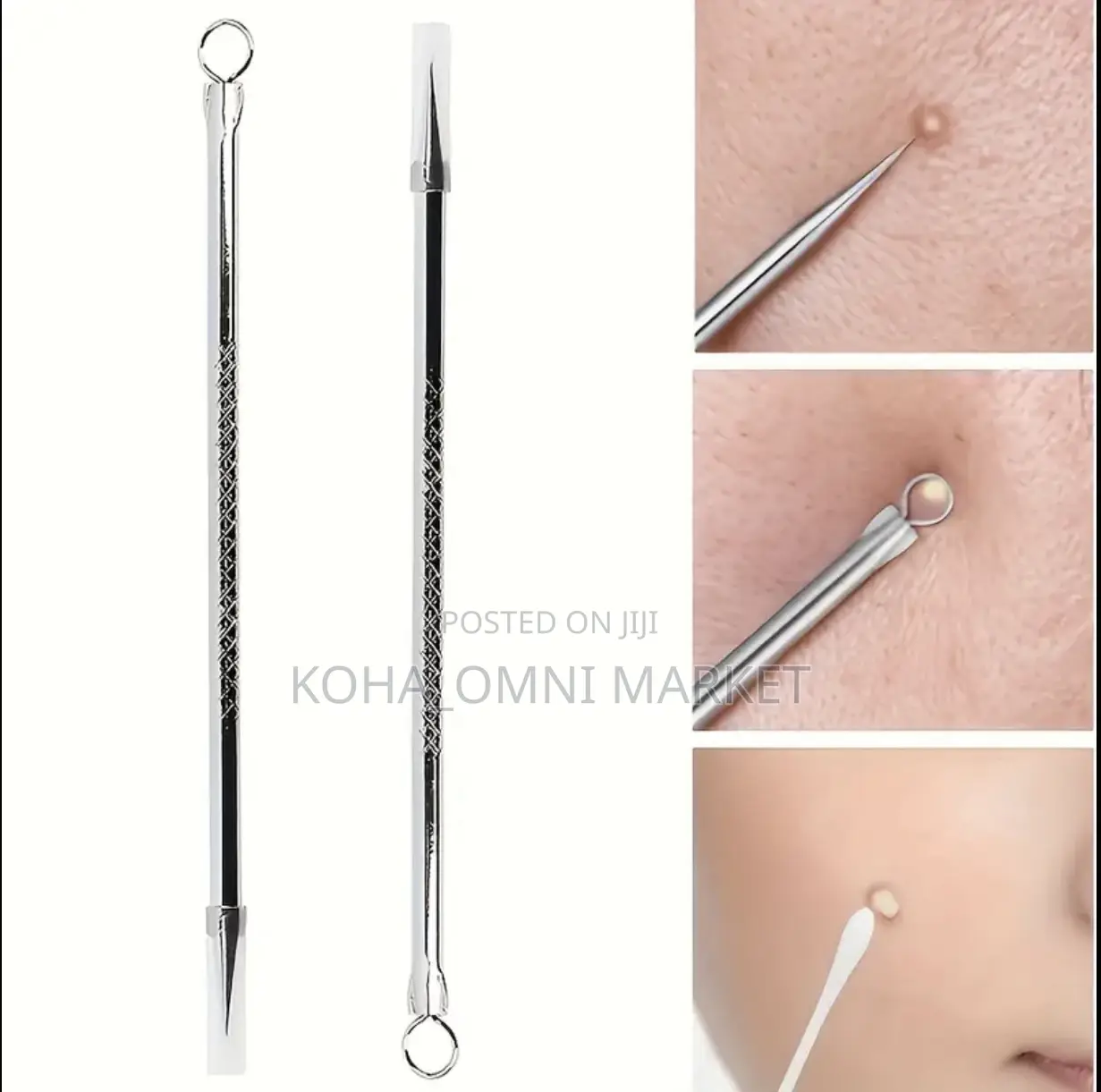 4pcs Pimple Extractor Tool Stainless Steel