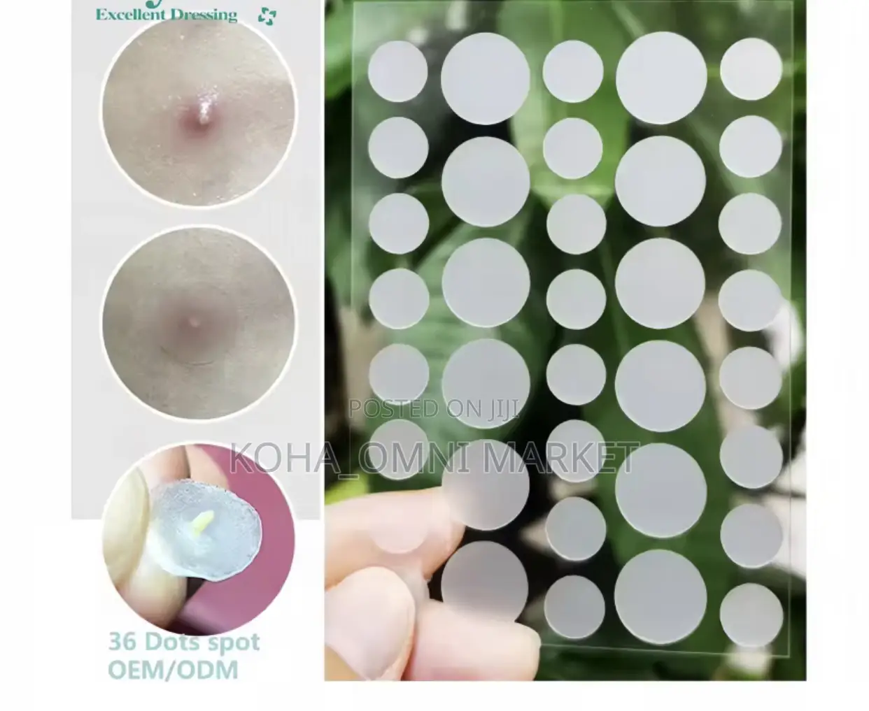 5pcs Invisible Hydrocolloid Pimple Patches