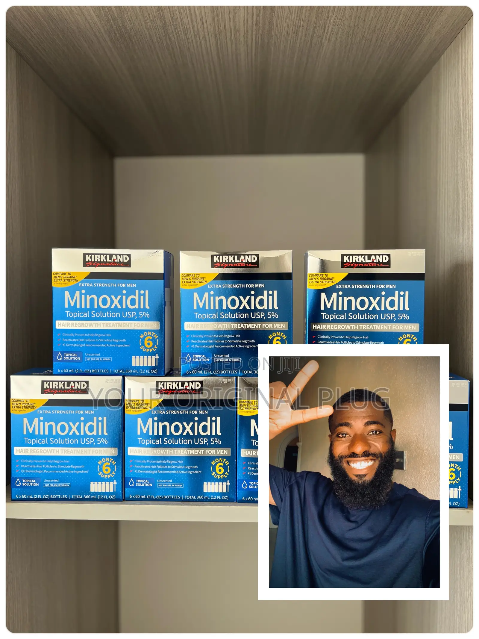 Kirkland Minoxidil 5% Undiluted Effective For Hair Regrowth (Box (1x6)