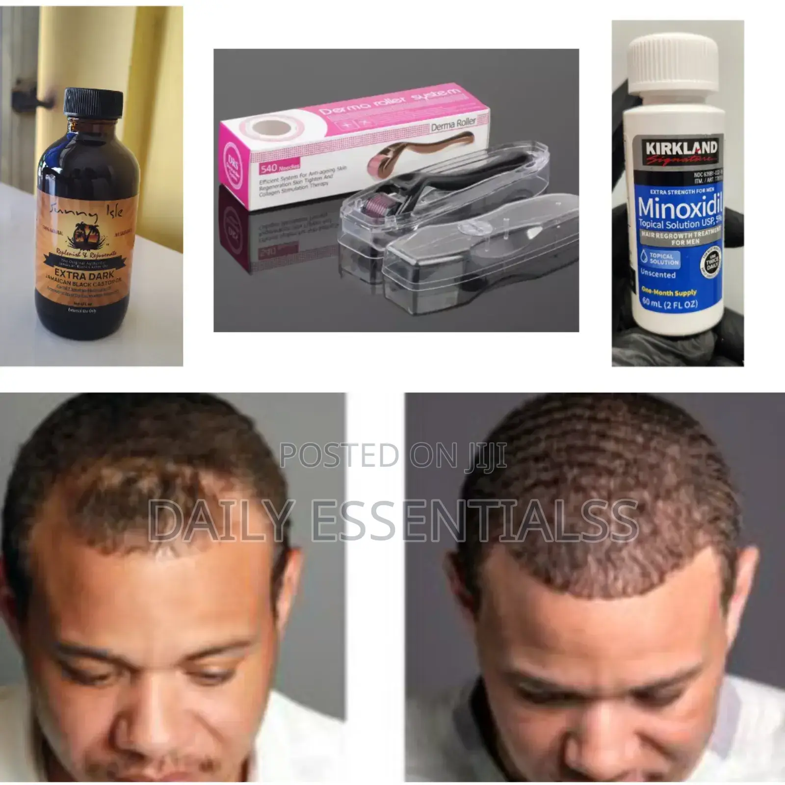 Thicker Hair Kit – Naturally Scientifically Backed