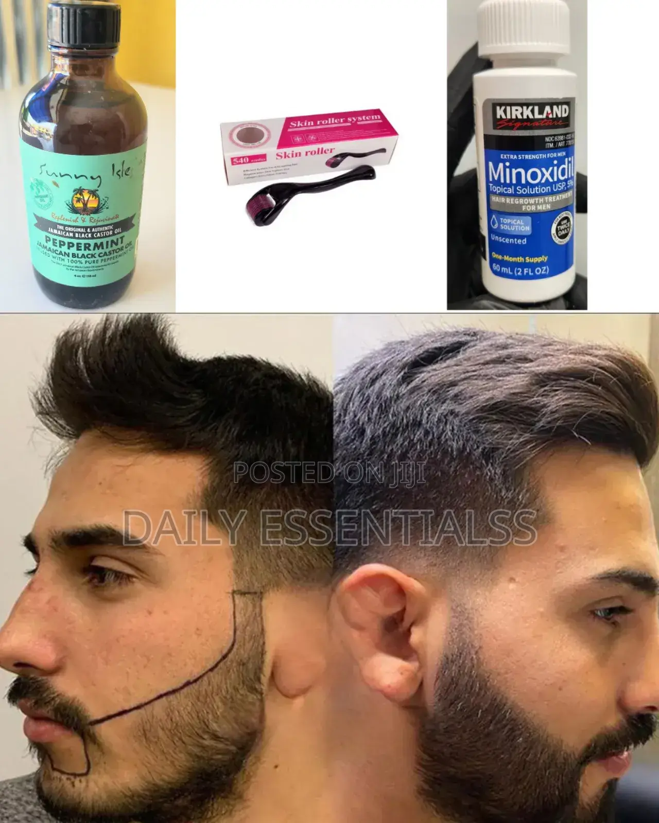 Kirkland Minoxidil + Peppermint + Derma Roller Kit