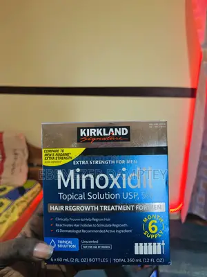 Say Goodbye to Hair Loss – Minoxidil to the Rescue!