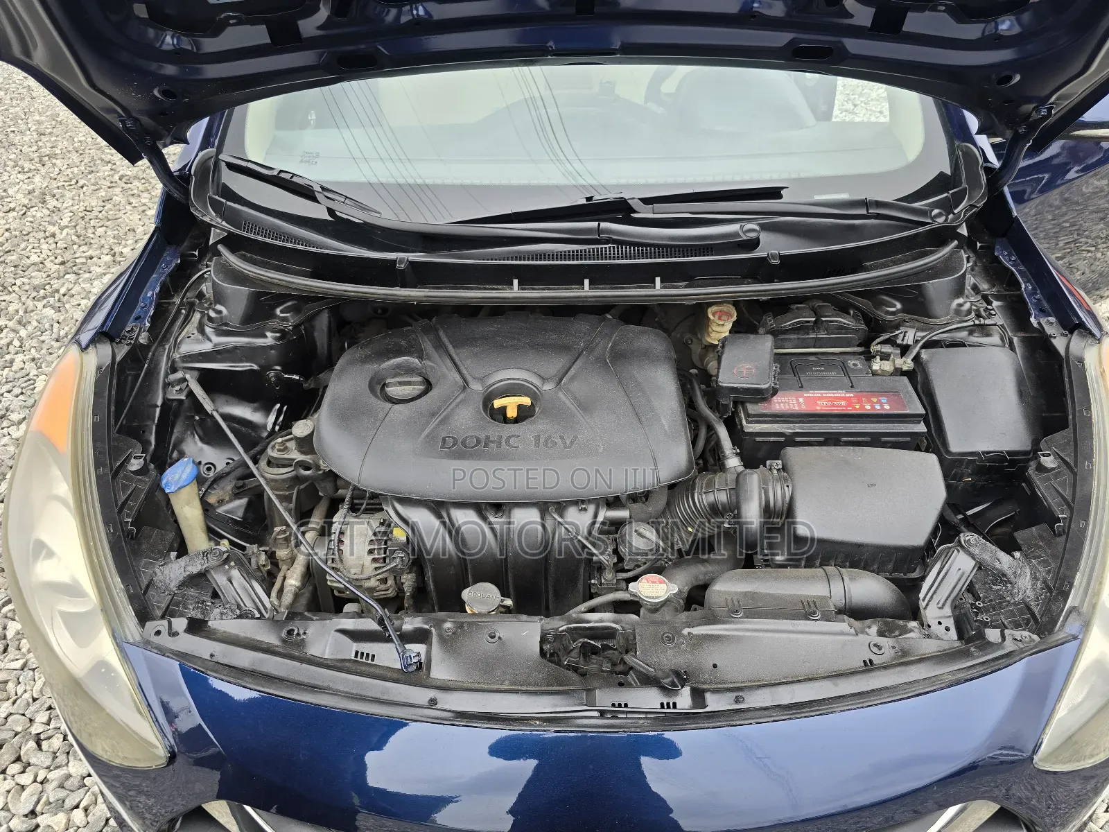 Hyundai Elantra SE Sedan FWD (2.0L 4cyl 6M) 2017 Blue