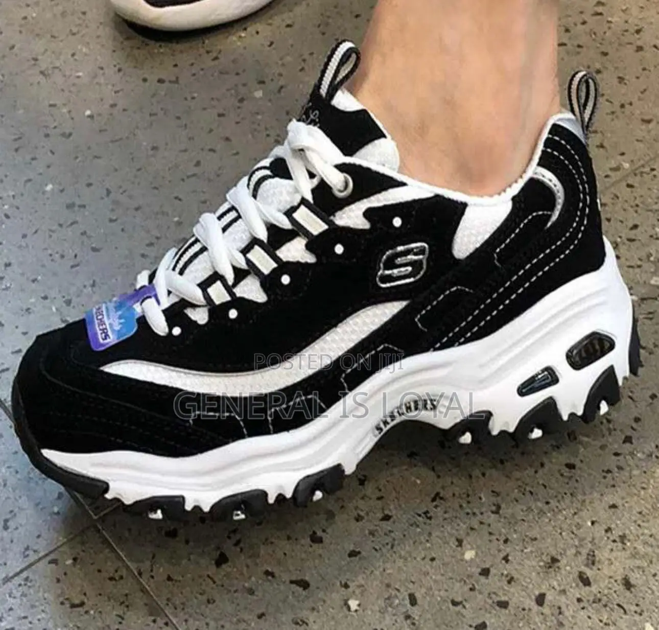 Sketchers Sneakers