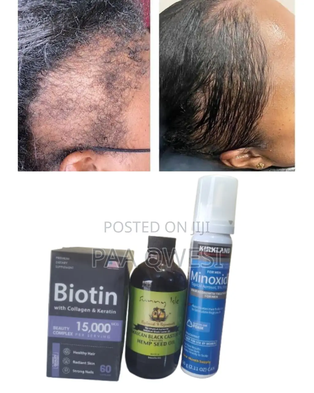 Biotin + Hemp Seed + Kirkland Foam