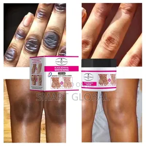 Photo - Aichun Whitening Creaminstantbrighten Elbows,Kneesdark Areas