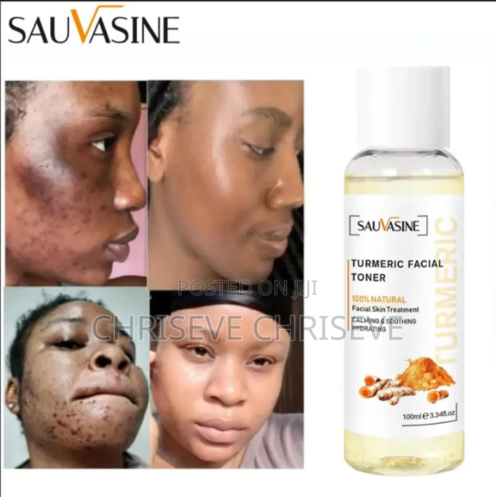 Tumeric Face and Neck Toner