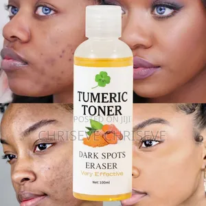 Tumeric Face and Neck Toner