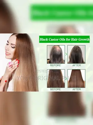 Jamaican Black Castor Oil, Extra Dark (Pure Blend)