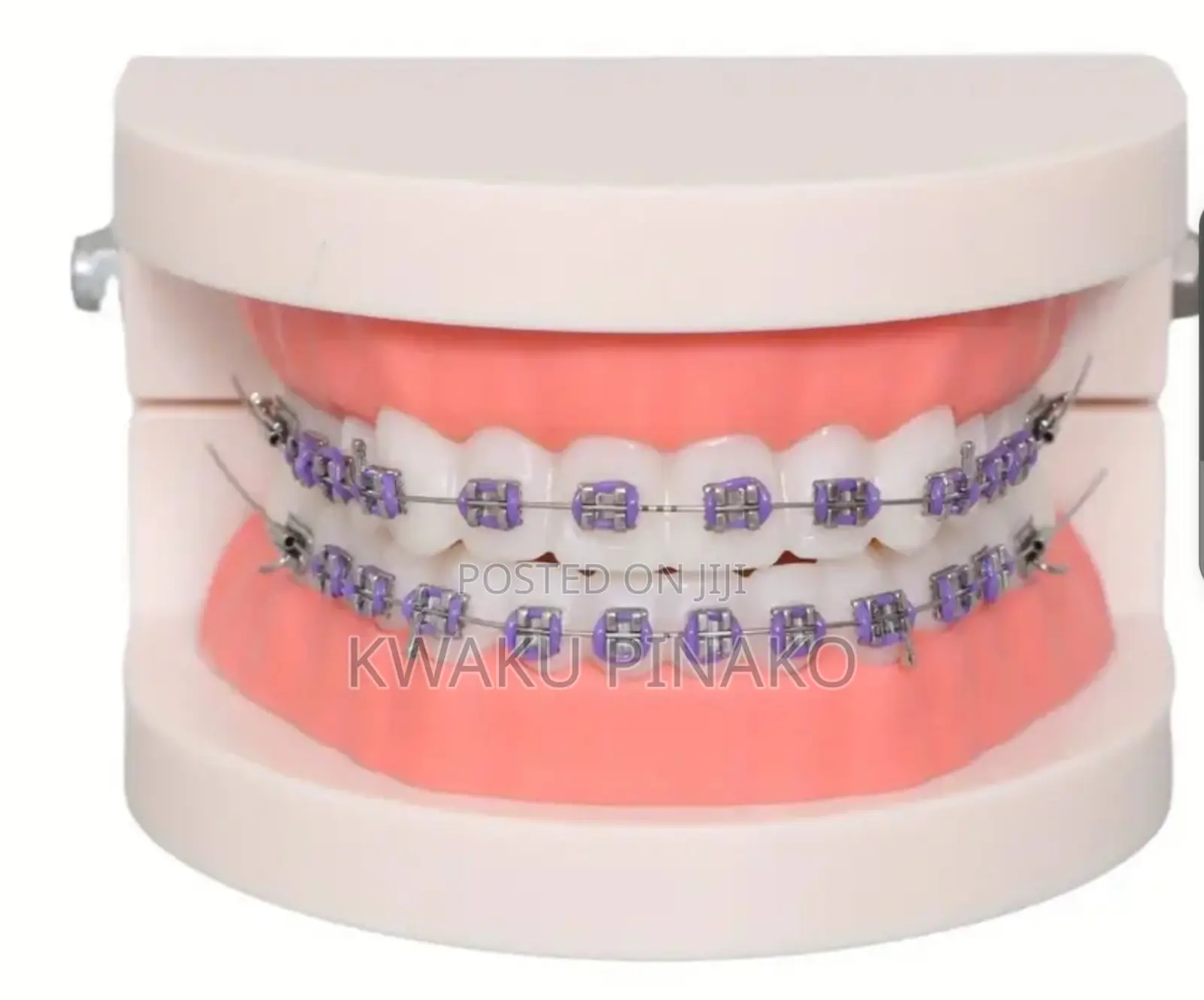 Fashion Braces for-Sale Cool Price