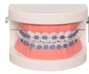 Fashion Braces for-Sale Cool Price
