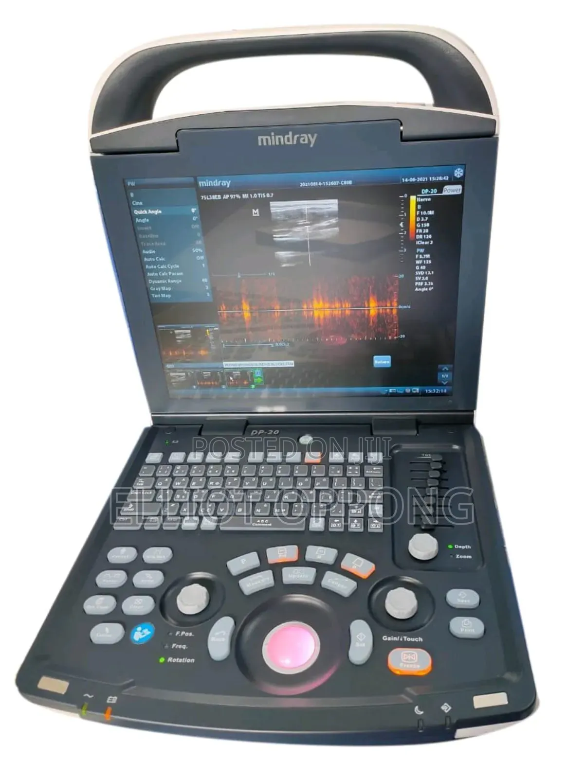 Mindray Dp10 Scan Machine + Printer