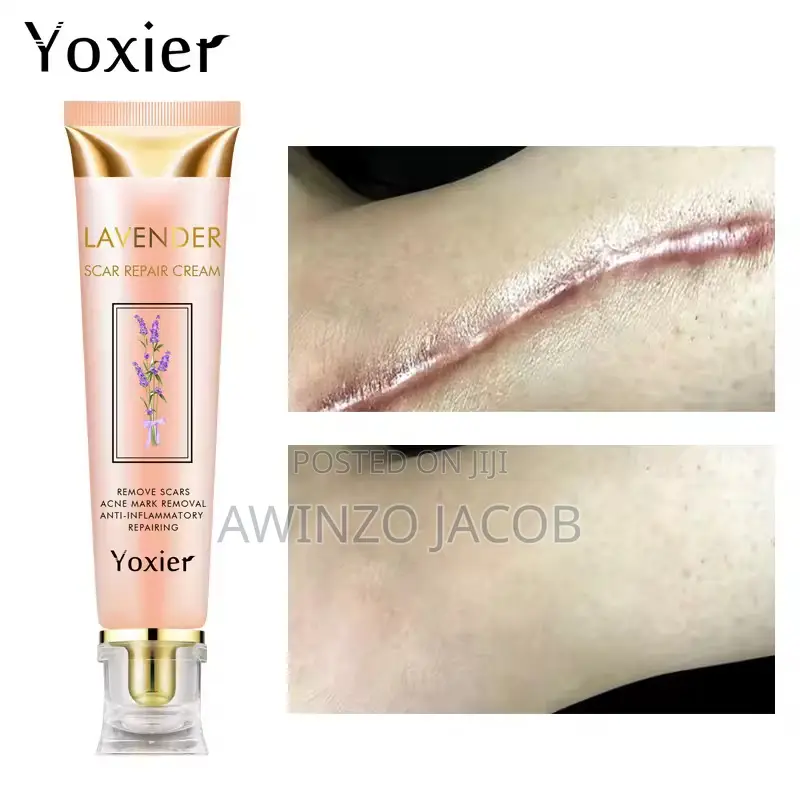 Original Yoxier Scar Remover