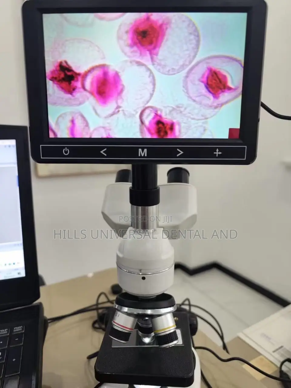 Binocular Microscope With Screen