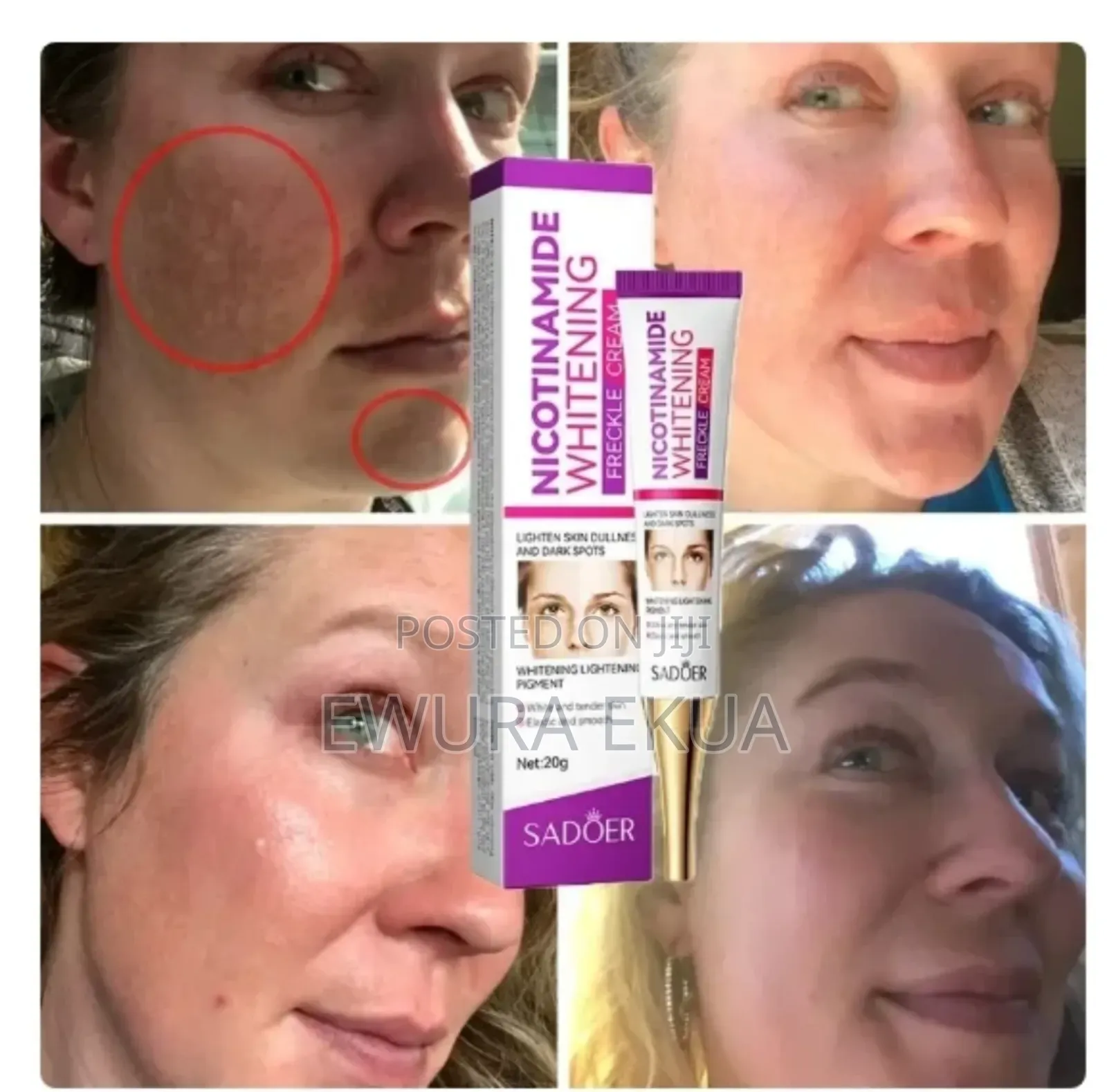 Nicotinamide Face Cream