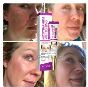 Nicotinamide Face Cream